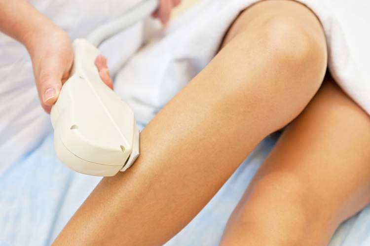 Laser hair removal removes hair without causing pain