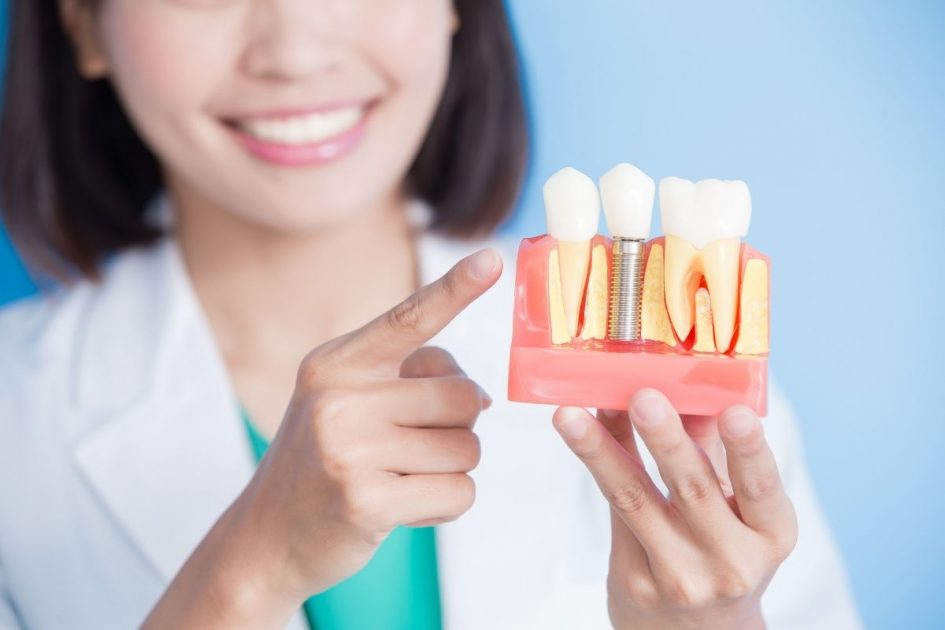 Dental implants are also oral procedures to renew your self-esteem