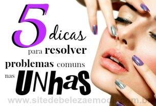 5 dicas para resolver problemas comuns nas unhas