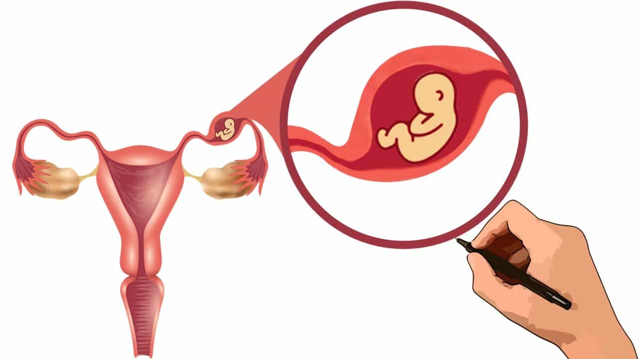 What is a gestational sac: what it is for and main problems