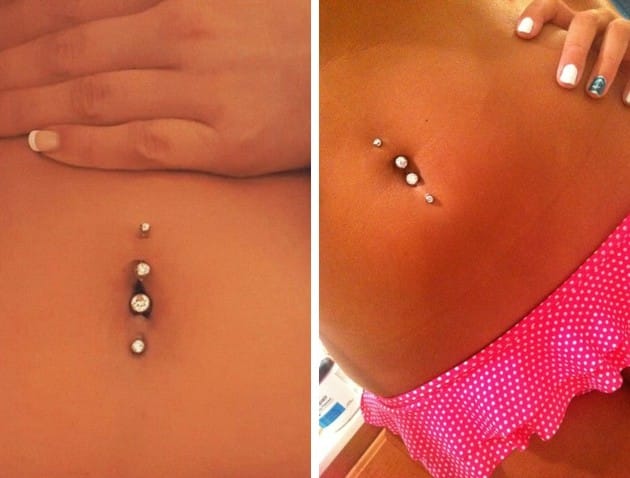 Is navel piercing dangerous?  It hurts?  All you need to know