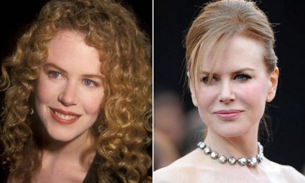 Nicole Kidman