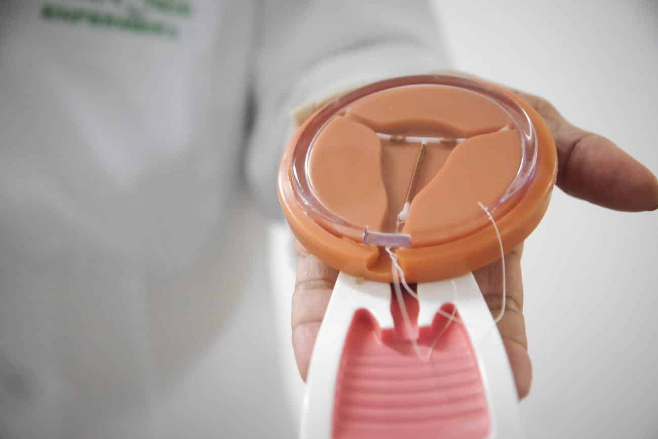 Types of IUD: how they work and what are the advantages of each one