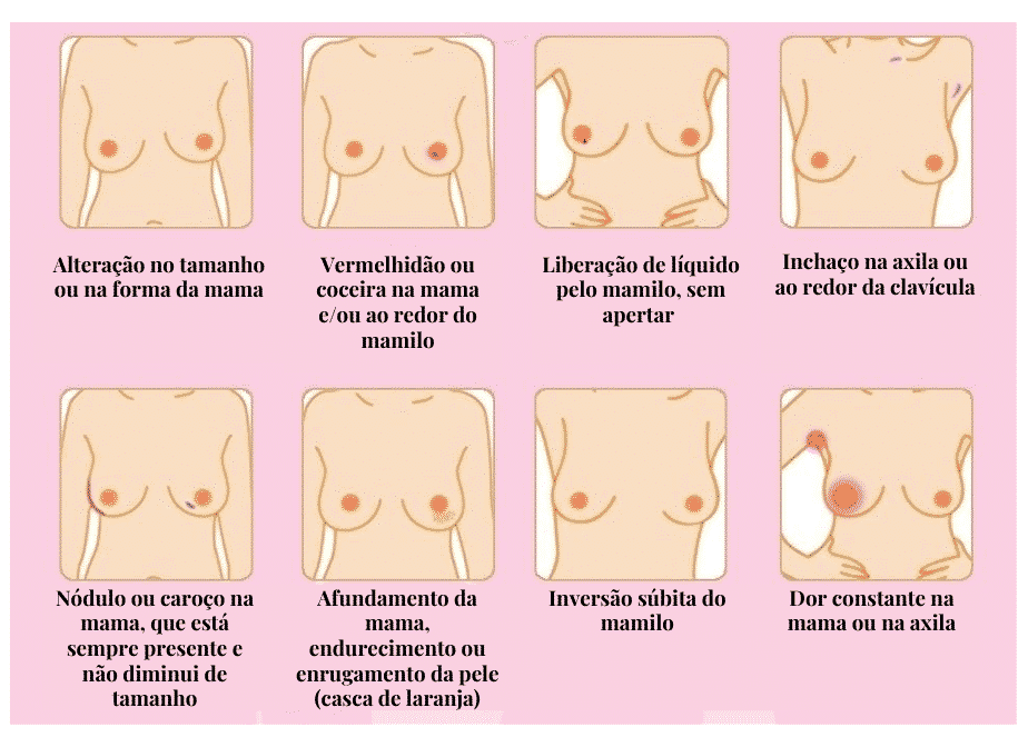How to do a breast self-exam: step by step and 12 warning signs