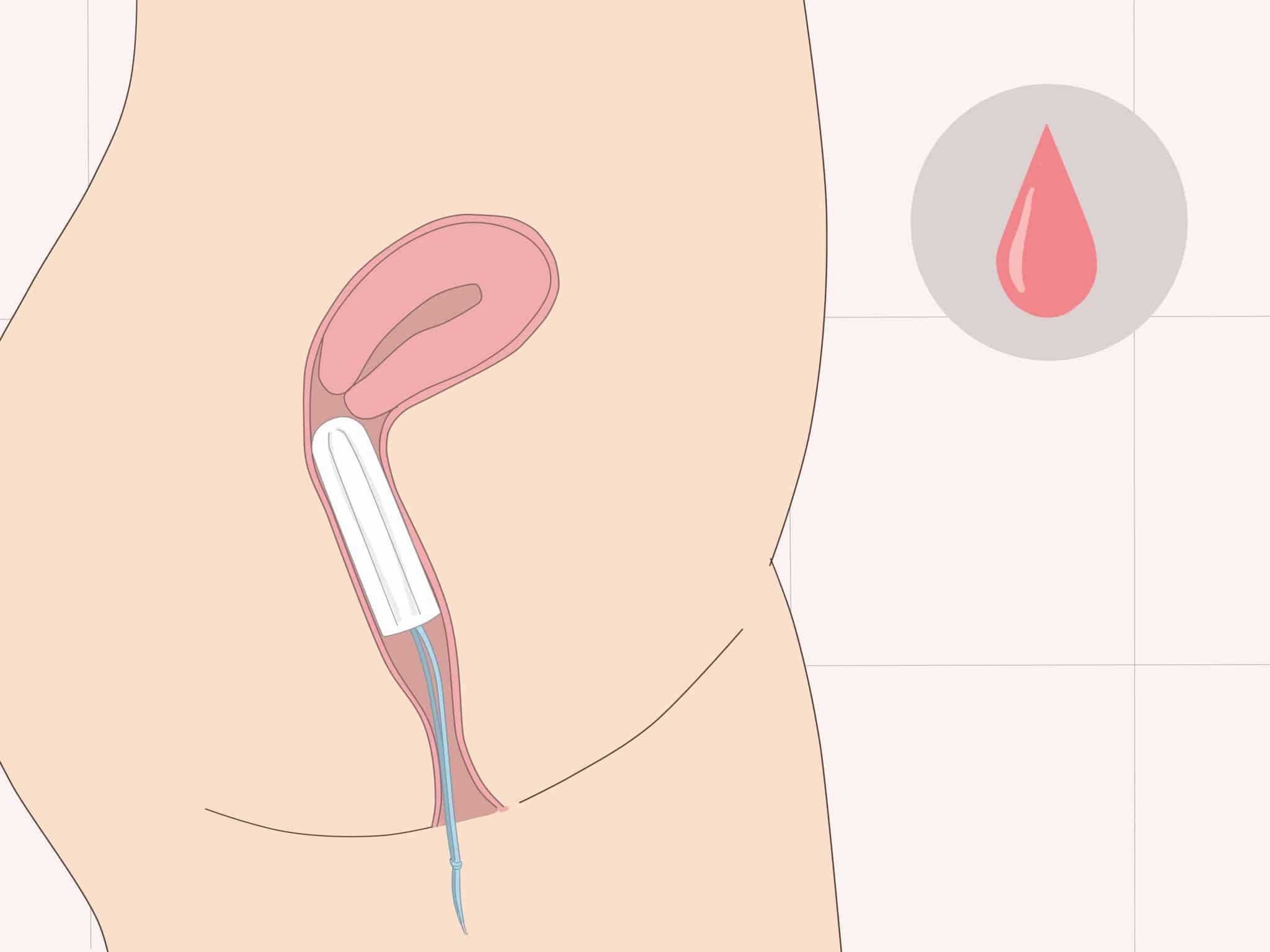 Comment retirer un tampon : conseils pour le retirer s'il reste coincé