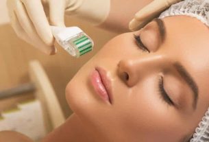 What is microneedling for?  Main benefits