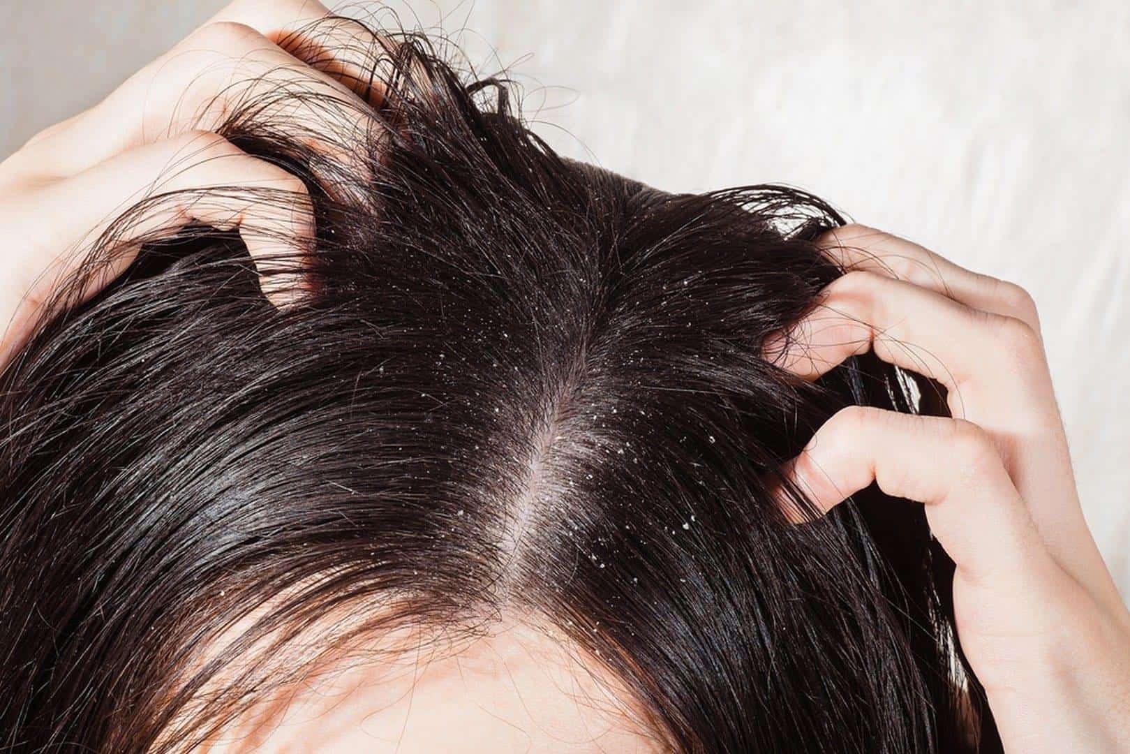 Wash your hair with mineral water