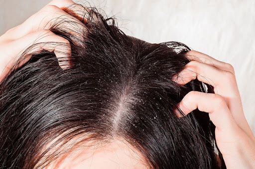 Hair loss - main causes and how to avoid it