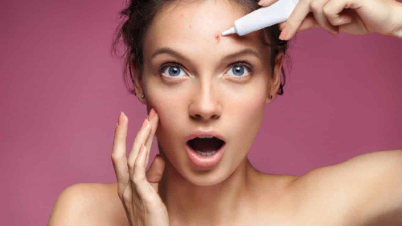 Acne treatments - Types of acne and what to do in each case