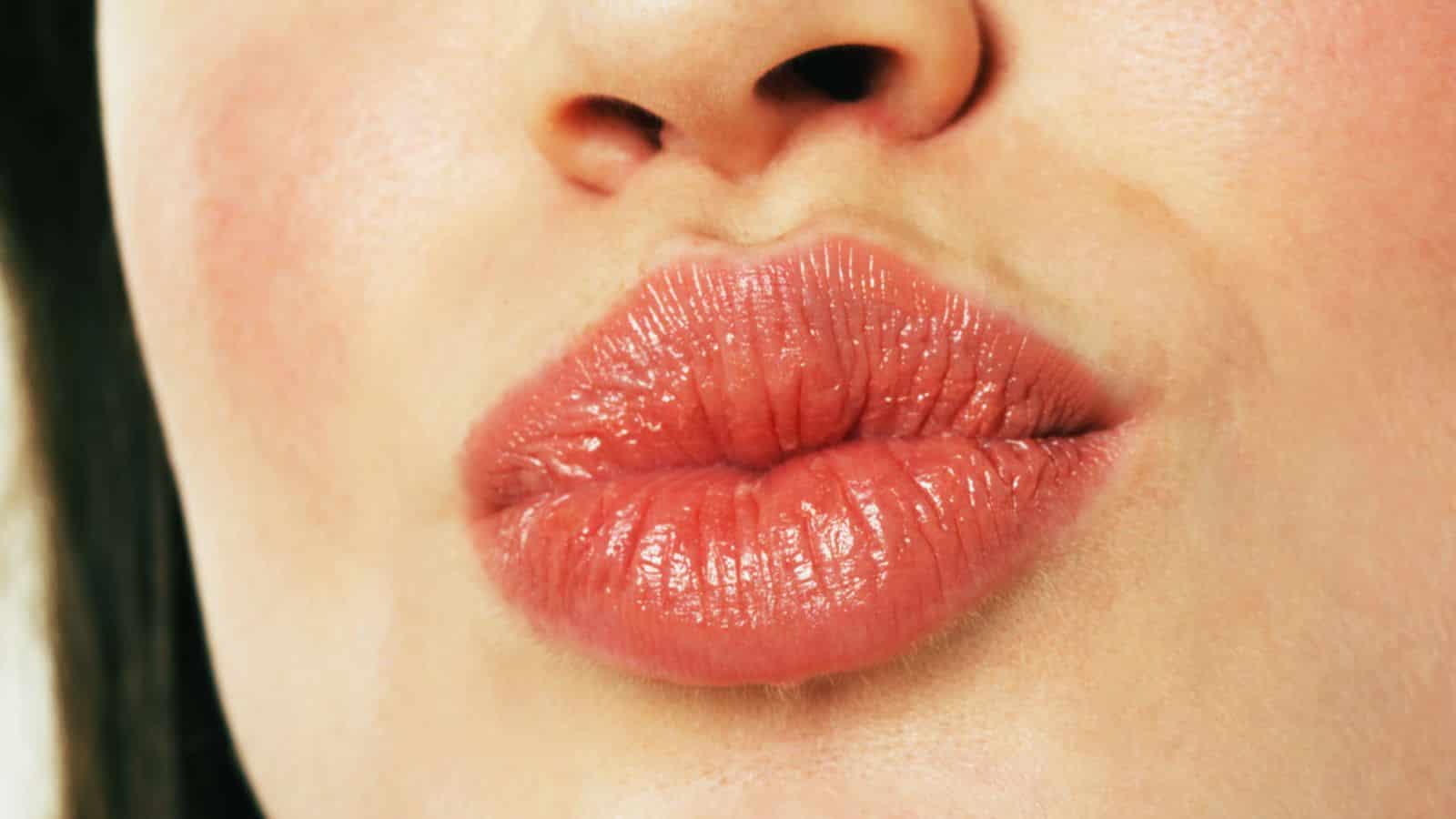 Fleshy lips