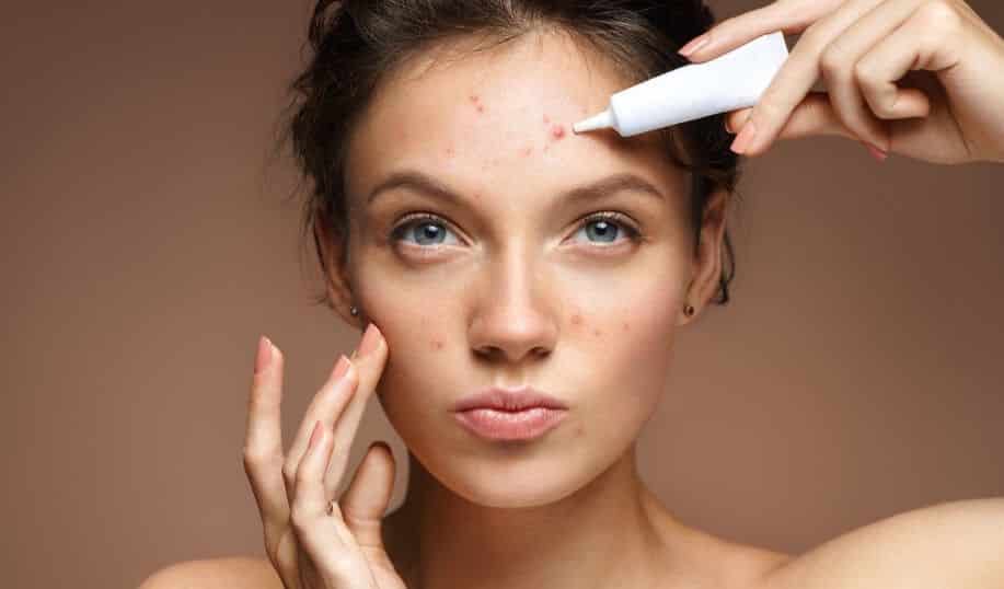 Pimple treatments - learn how to avoid acne