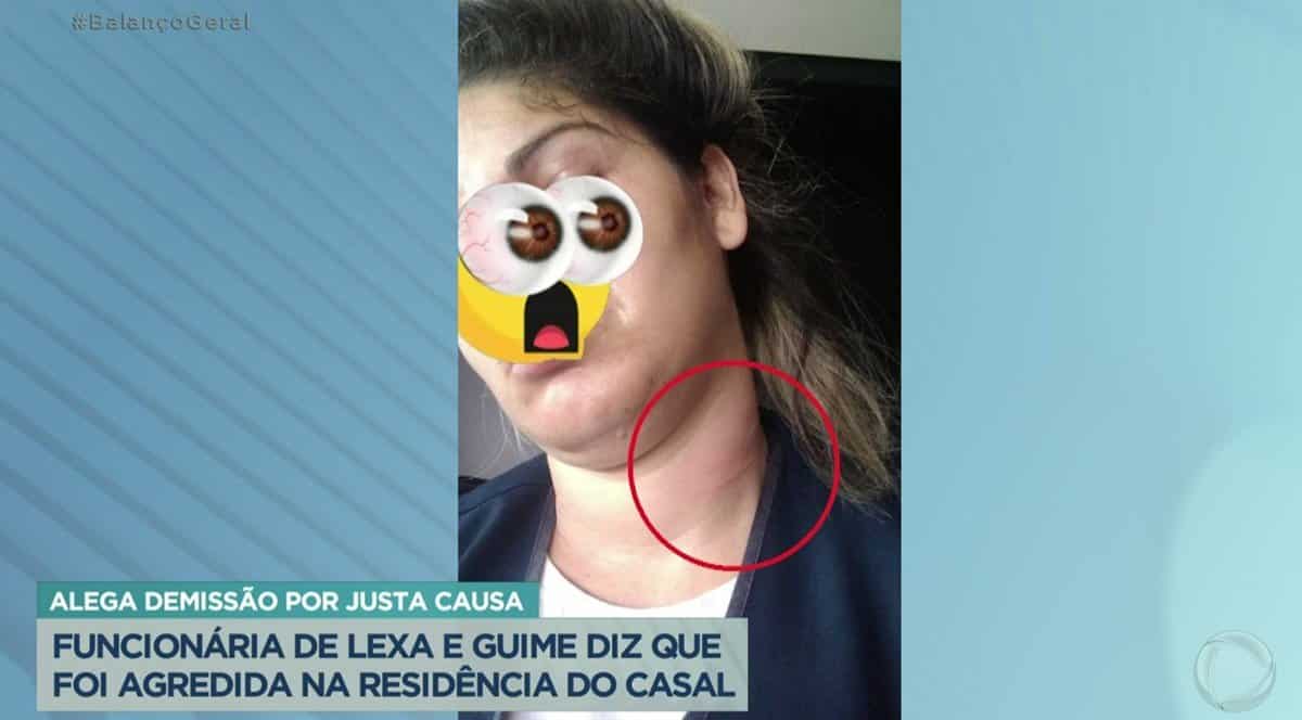 Funcionária de Lexa alega ter sido agredida na casa da cantora