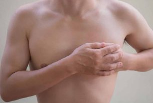 Breast cancer in men