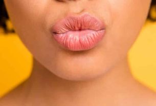 Swollen lips - Main causes and how to treat each problem