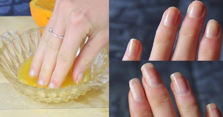 Find out how to make your nails grow quickly and naturally