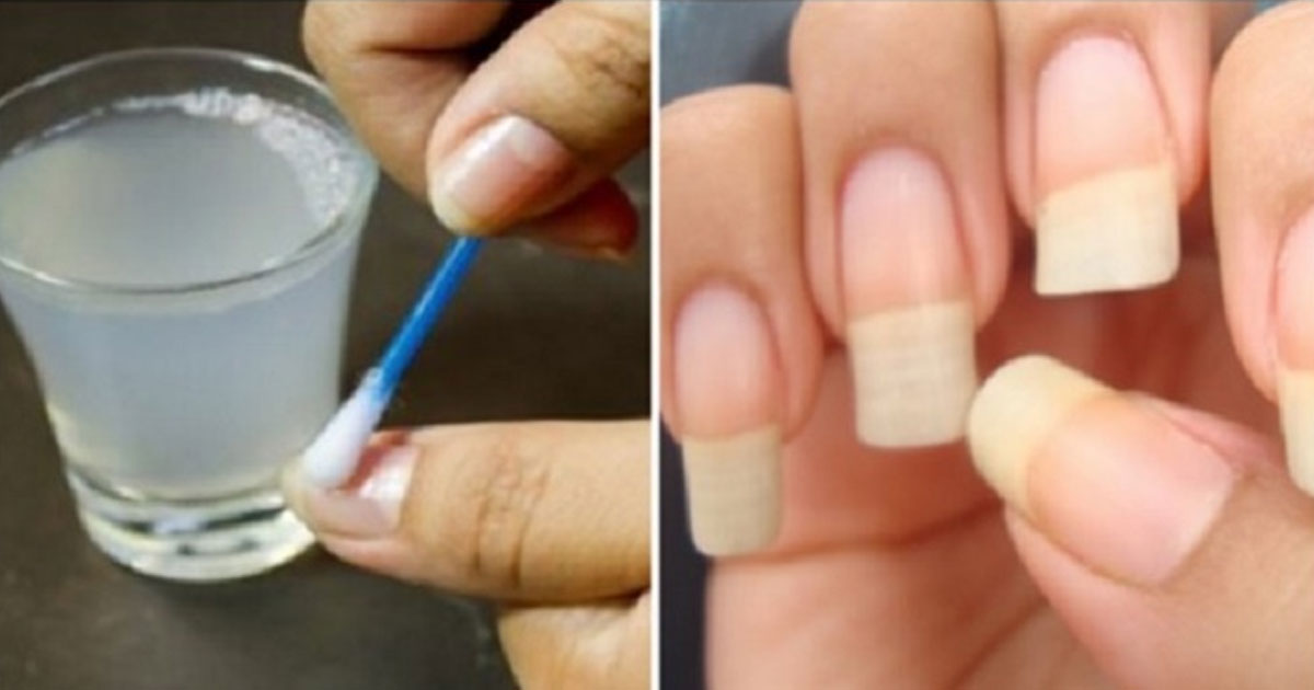 receitas caseiras para fazer as unhas crescerem muito mais rápido