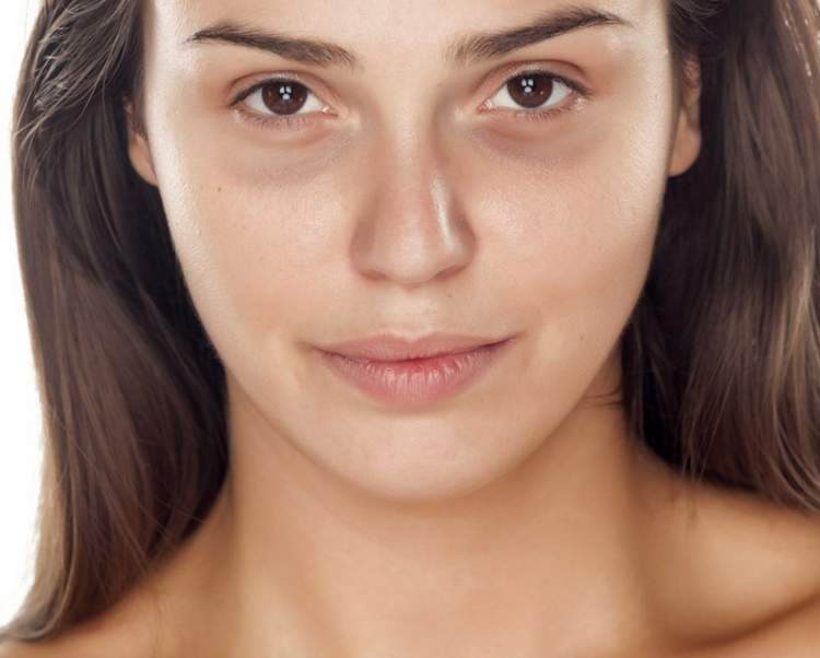 Woman with dark circles