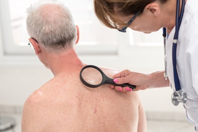 Back folliculitis: what it is, symptoms, causes and treatment