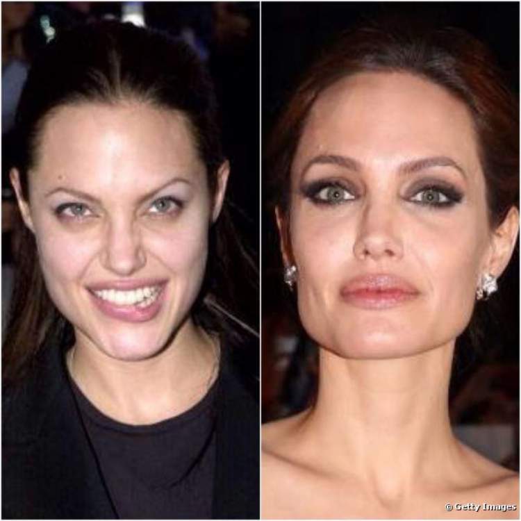 Angelina Jolie's Eyebrows - Before and After