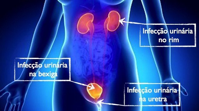 Find out how to prevent and treat urinary tract infections