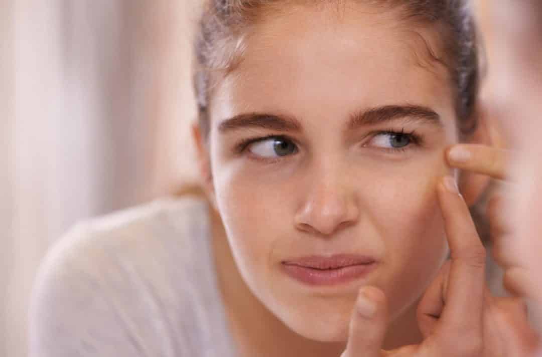 Holes on the face: Tips for prevention and treatments for removal