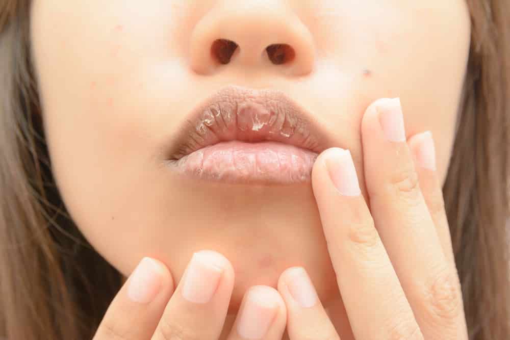 How to moisturize your lips