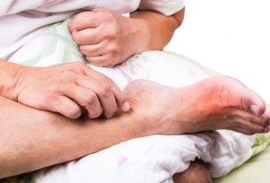 How to treat Gout: most used remedies