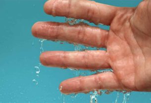 Hyperhidrosis, what is it?  Symptoms, treatments and who may have it