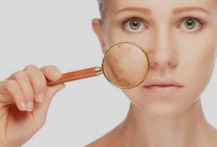 Spotted skin, what is it?  Causes, prevention and treatments