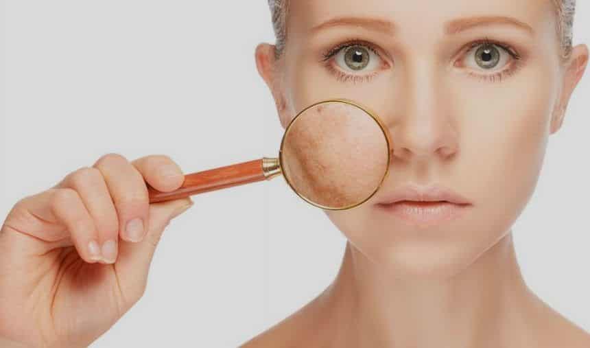 Spotted skin, what is it?  Causes, prevention and treatments