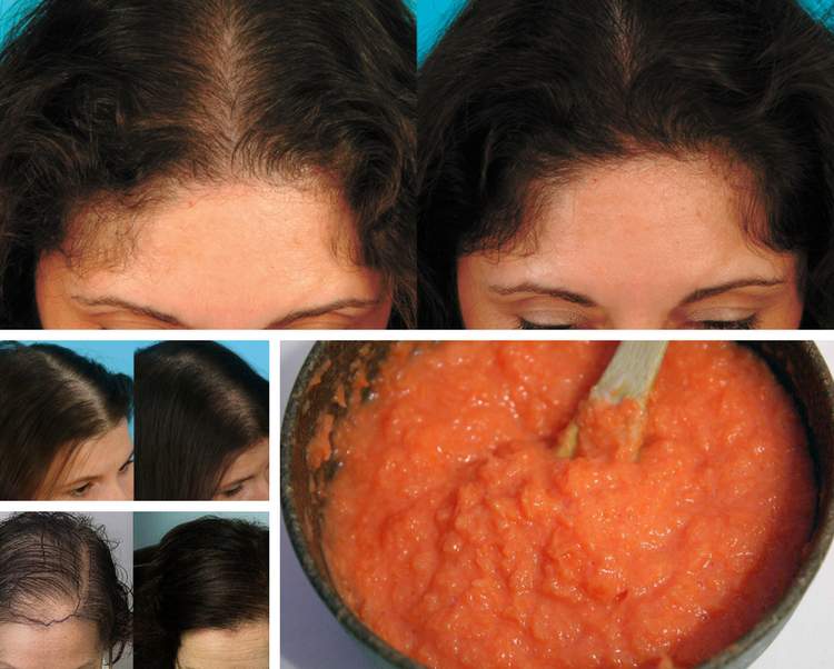 Stop your hair from falling out with this very simple homemade recipe