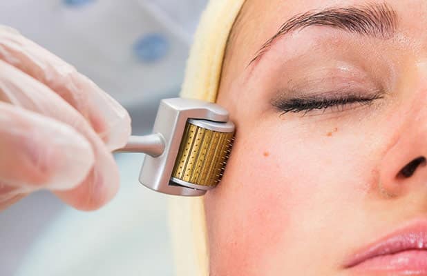 What is microneedling for?  Benefits and contraindications