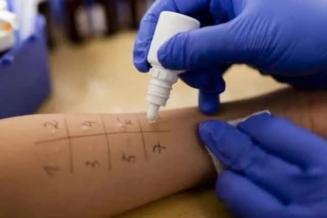 Allergy test