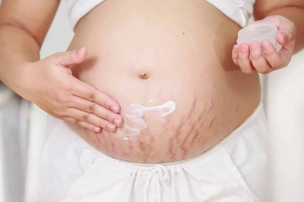 Pregnancy skin care – what to do and why it’s so important