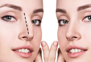 How much does a rhinoplasty cost?  What determines the cost of surgery