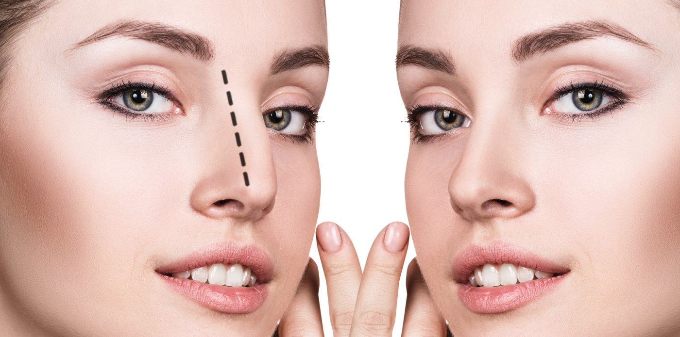 How much does a rhinoplasty cost?  What determines the cost of surgery