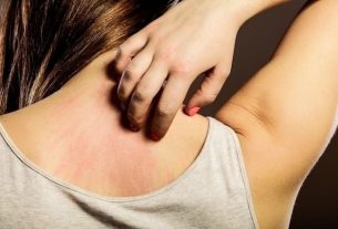 7 types of skin mycosis (and how to treat it)