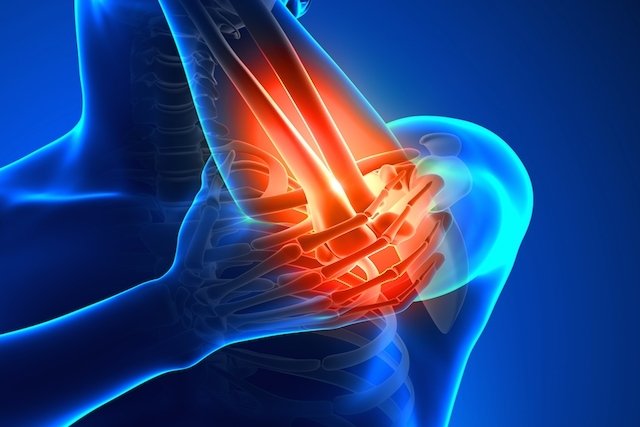 Elbow tendinitis: main symptoms and treatment