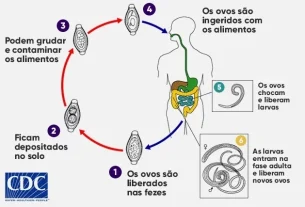 di cosa si tratta, sintomi e trattamento