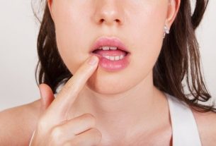 Herpetic stomatitis: what it is, causes and treatment