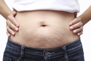 6 best treatments for sagging belly