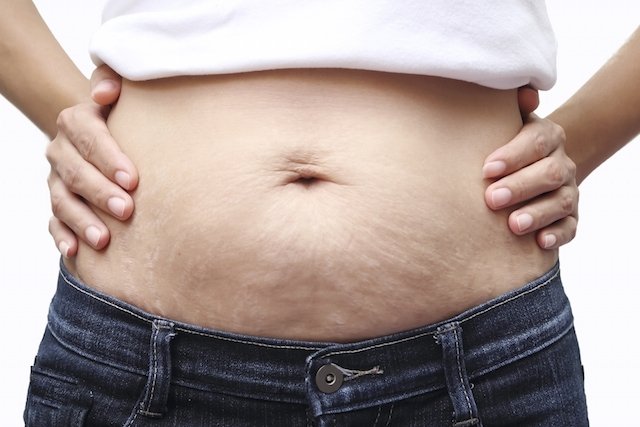 6 best treatments for sagging belly