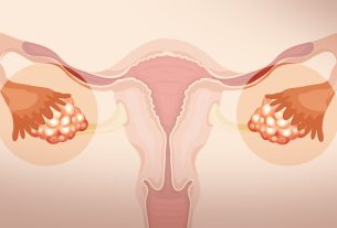 Ovário policístico- O que é, causas, sintomas, tratamentos e curiosidades