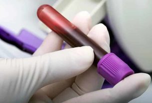 Exame de gravidez de sangue como funciona? O que é Beta HCG?