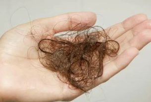 Main causes of hair loss and how to combat them