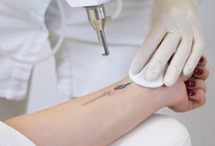 Tattoo removal: how to remove and care