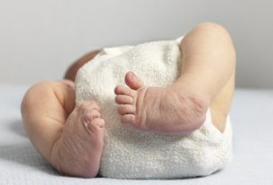 Congenital clubfoot: what it is, how to identify and treatment