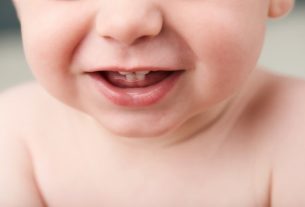 What causes swollen gums in babies (and what to do)