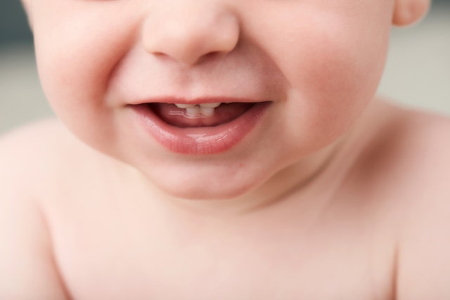 What causes swollen gums in babies (and what to do)