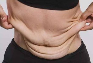 7 dicas valiosas para acabar com a flacidez do seu corpo